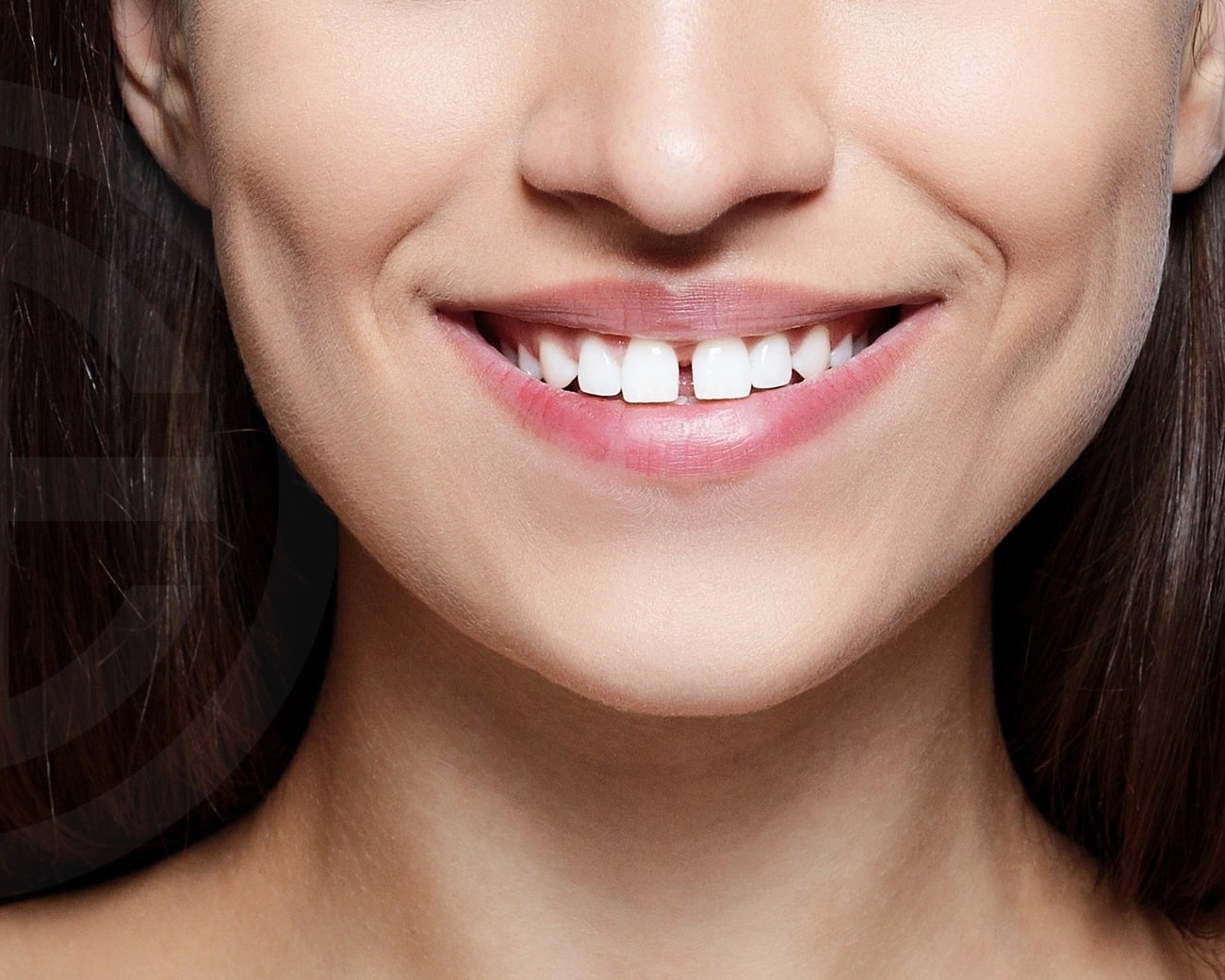 Espaces entre les dents
