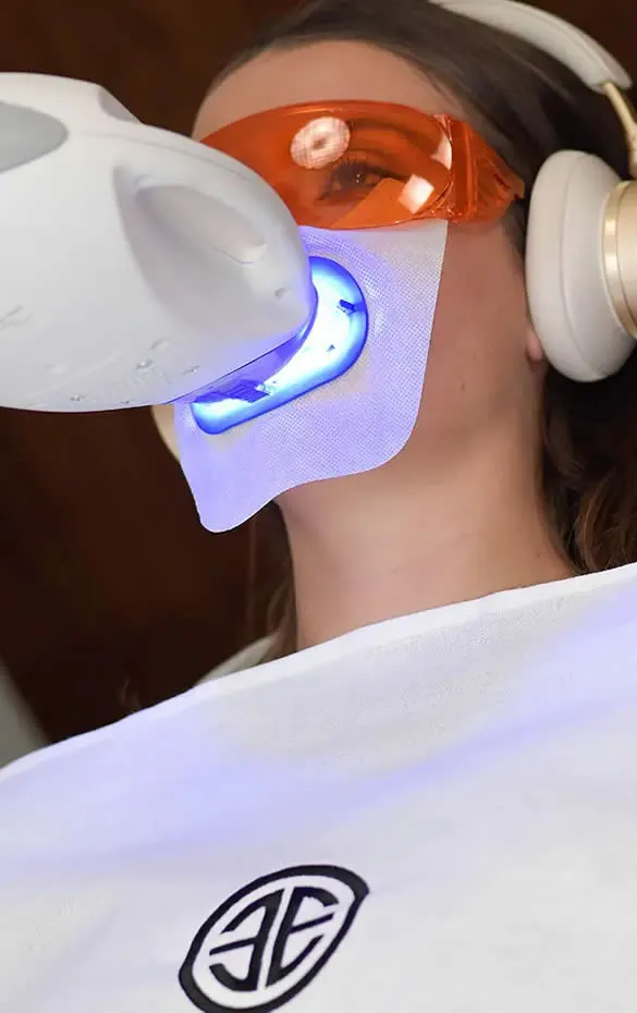 techniques de blanchiment