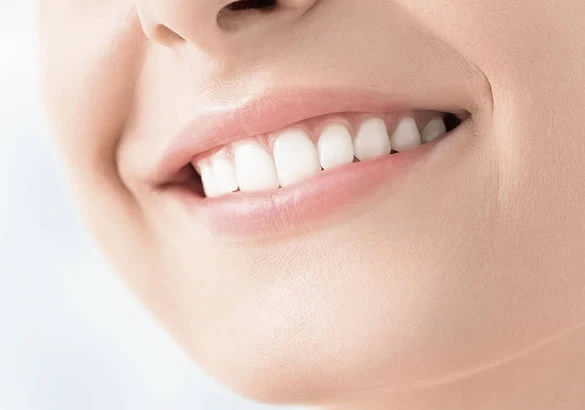 Comment avoir les dents droites ?