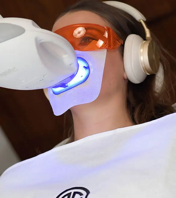 Professional teeth whitening lamp, Elone Clinic Paris
