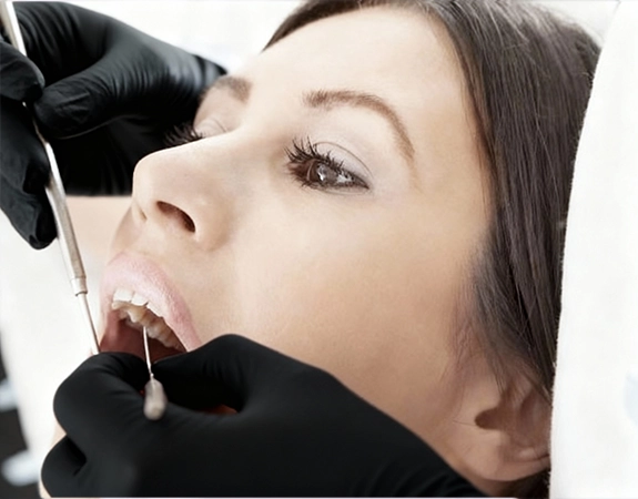 sourire gingival