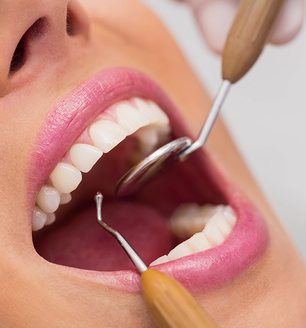 Causes d’un sourire gingival