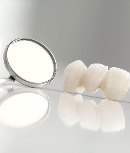 Couronne céramique pressée E-max
