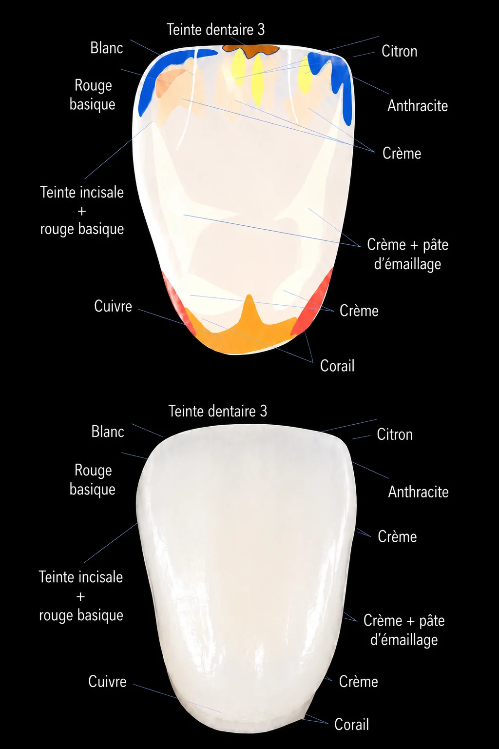 Schéma de stratification d’une facette en céramique feldspathique : répartition des masses blanc, citron, anthracite, crème, corail, cuivre et rouge basique du collet au bord incisif, et rendu de la pièce après cuisson