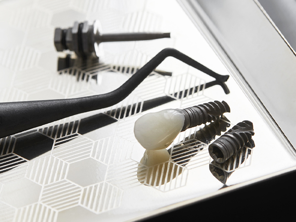 Quelle est la durée de vie d’un implant dentaire ?