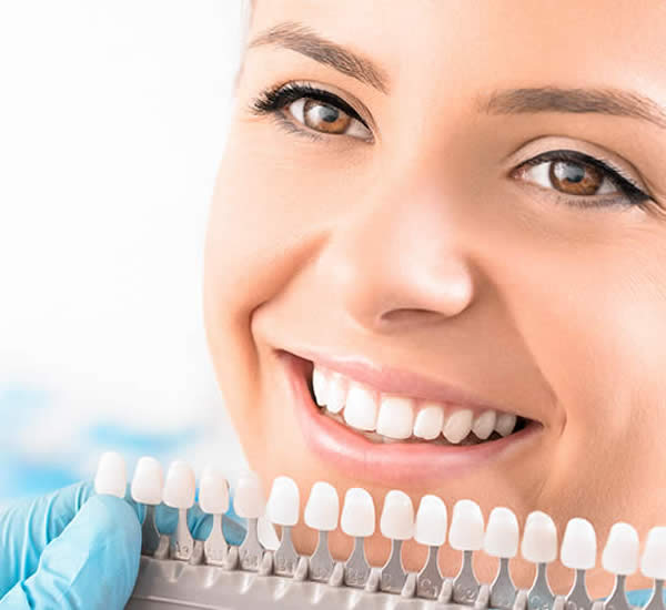 remplacement facette