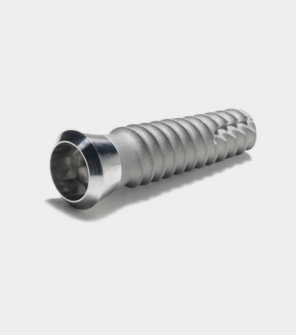 coût de l’implant dentaire