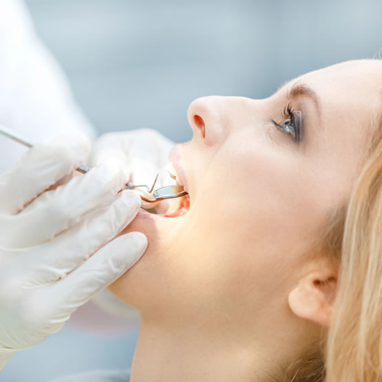 blanchiment des dents
