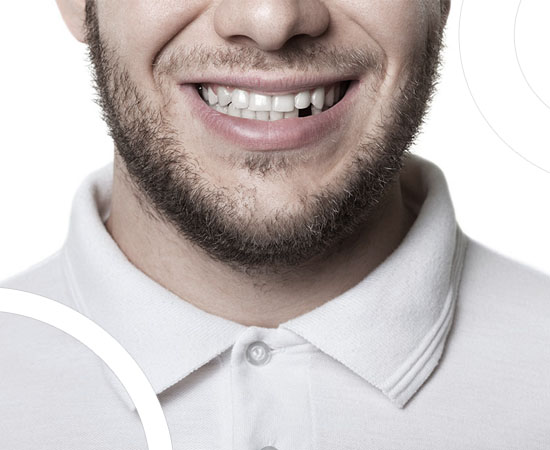 La perte de dents est une complication d'une infection bucco-dentaire