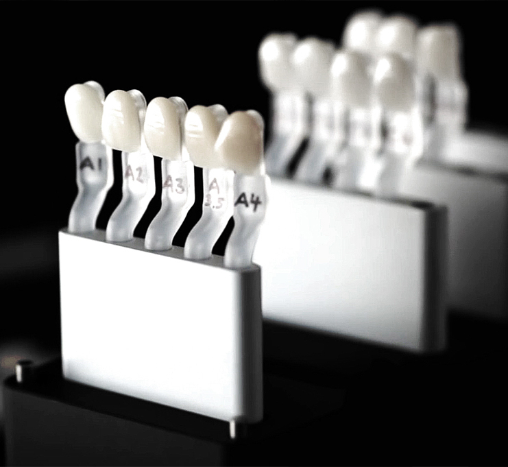 Refaire les dents de devant